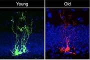 Study reveals neural stem cells age rapidly